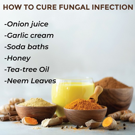 Ayurvedic treatment for symptoms of fungal infection
