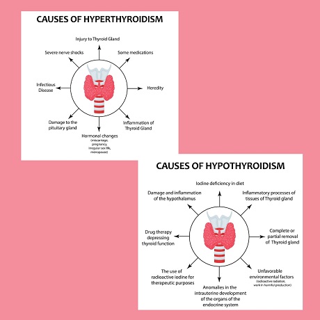 Causes and thyroid problem