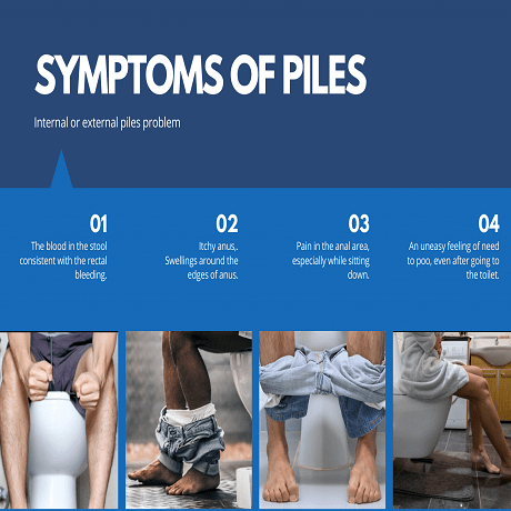 Symptoms -of - piles